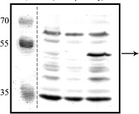 CpxA | Conjugative plasmid expression in the group Antibodies Other Species / Bacteria at Agrisera AB (Antibodies for research) (AS13 2653)